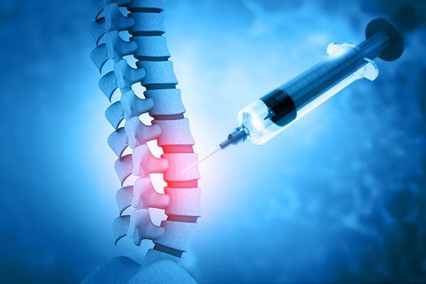 Spine Injections Sterling: A Non-Surgical Solution for Pain Relief